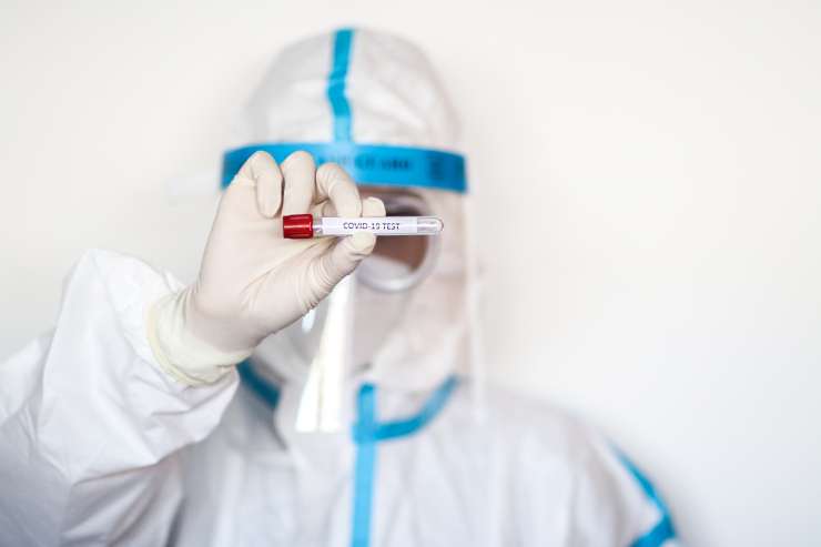 KORONAVIRUS: Včeraj 537 novih okužb, umrlo 31 covidnih bolnikov