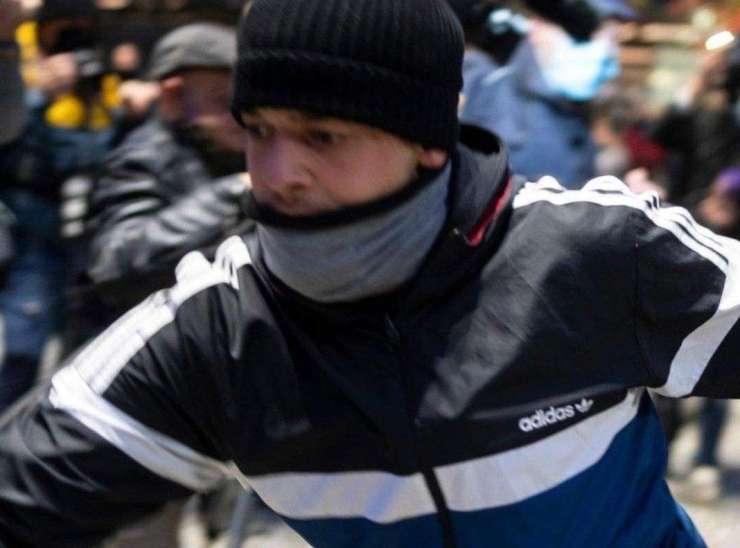 Fotoreporter Živulovič, ki mu je nasilnež na protestu zlomil čeljust, od napadalca zahteva 19.500 evrov odškodnine