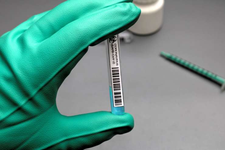 V Sloveniji potrjena tudi nigerijska različica koronavirusa, med okuženimi dva otroka