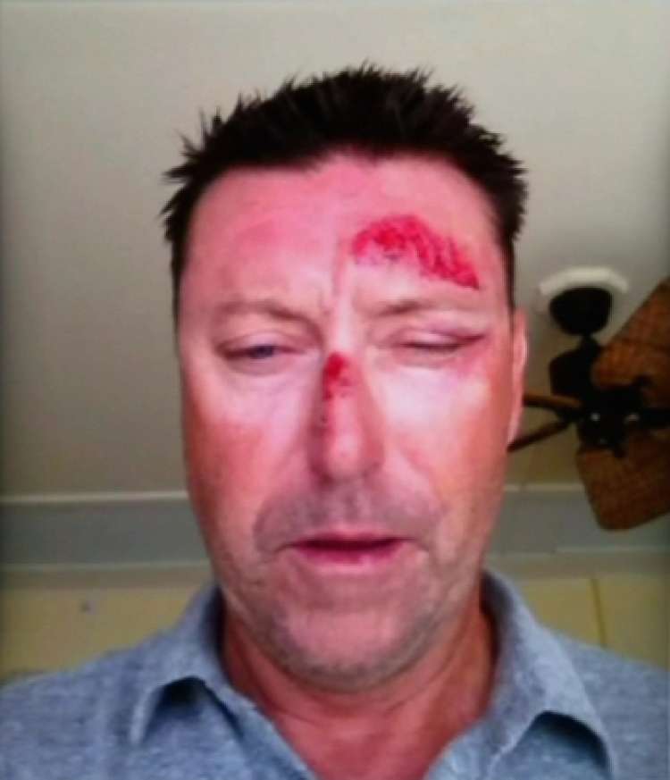 robert-allenby-assault-golf-channel