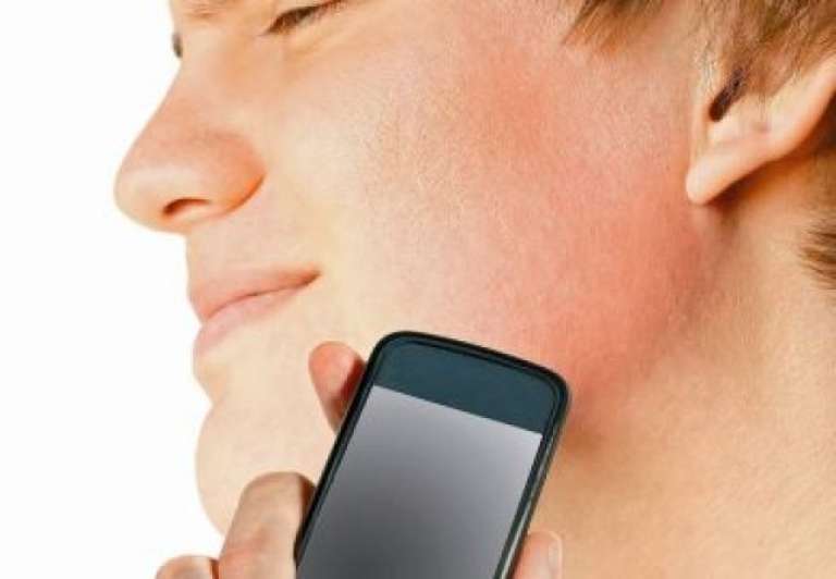 Alergija na mobilne telefone