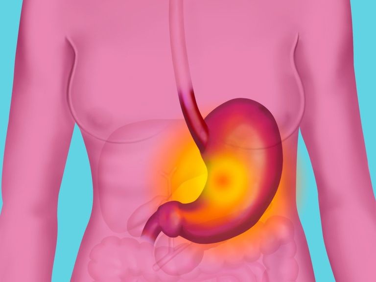gastritis profimedia.jpg