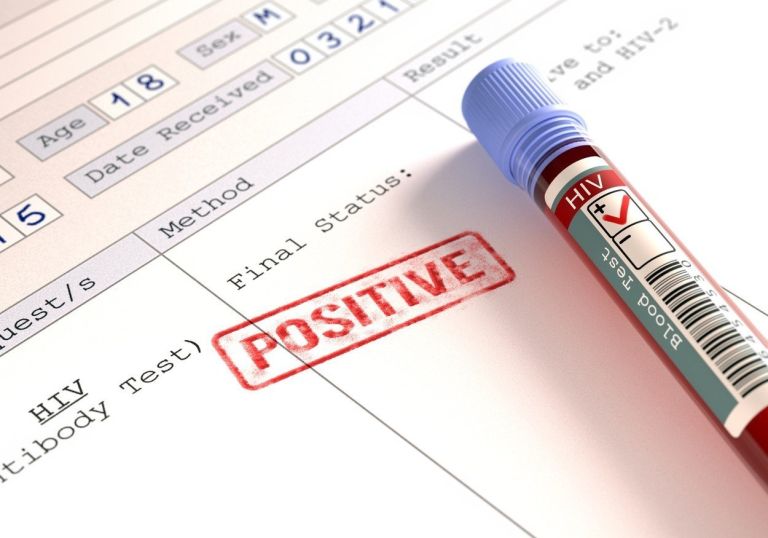 virus hiv test.jpg