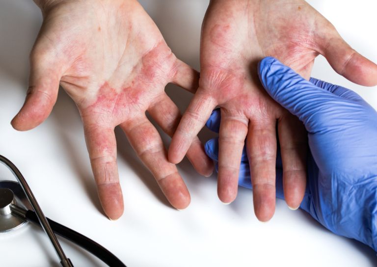 Dermatologija
