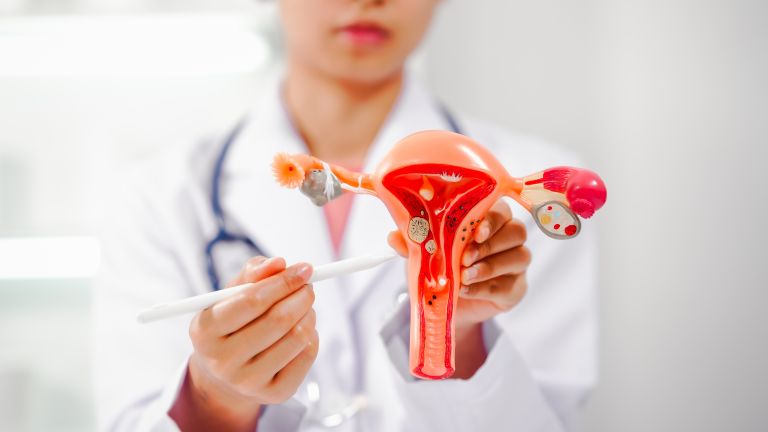 Endometrioza.jpg