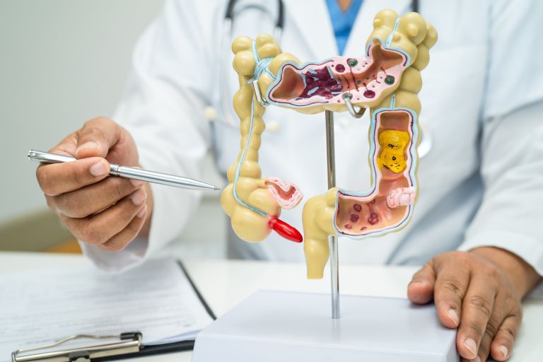 slepič, slepo črevo