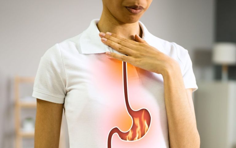 refluks, zgaga, gerb