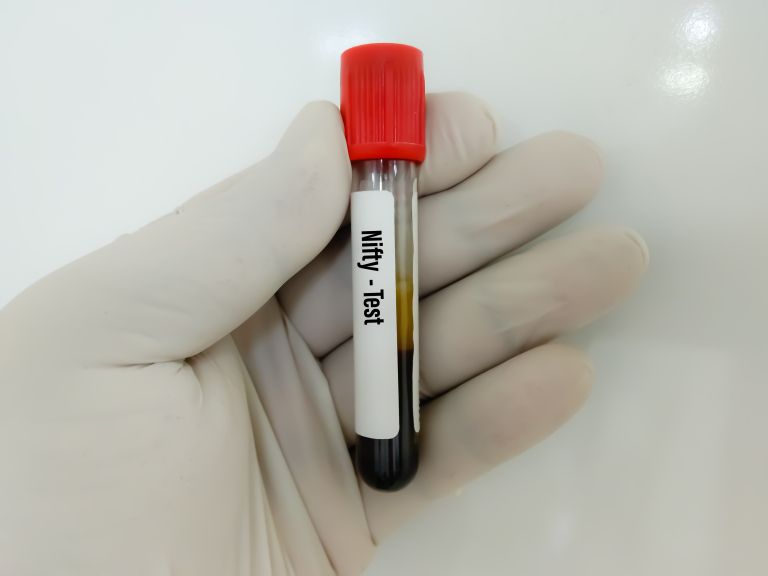 Nifty test.jpg