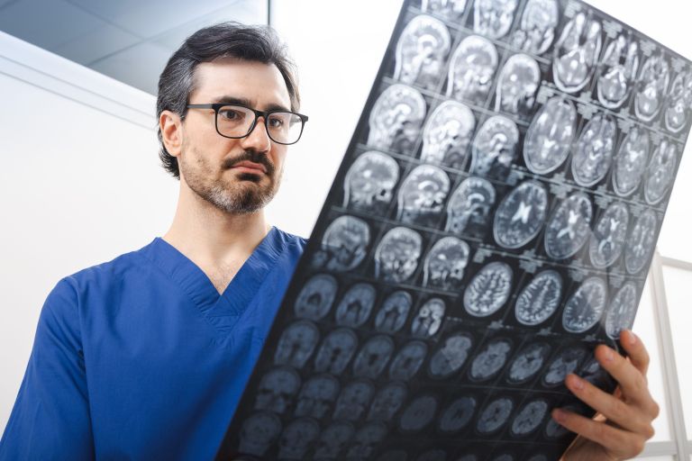 možgani, zdravnik, tumor