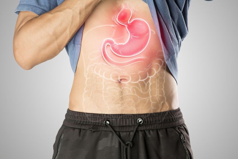 kila, prebavila, trebuh