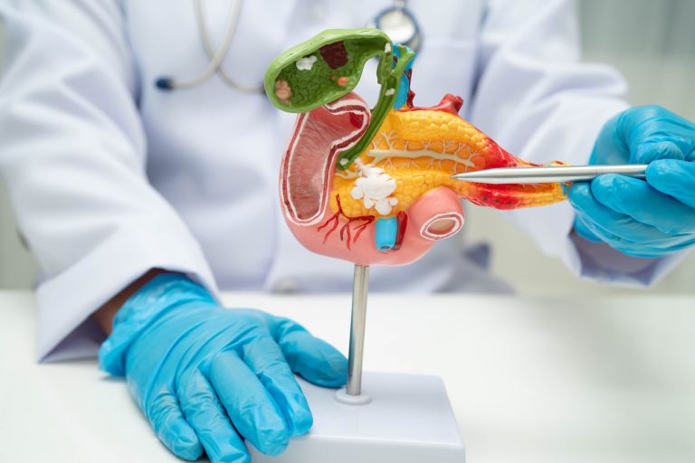 Rak trebušne slinavke