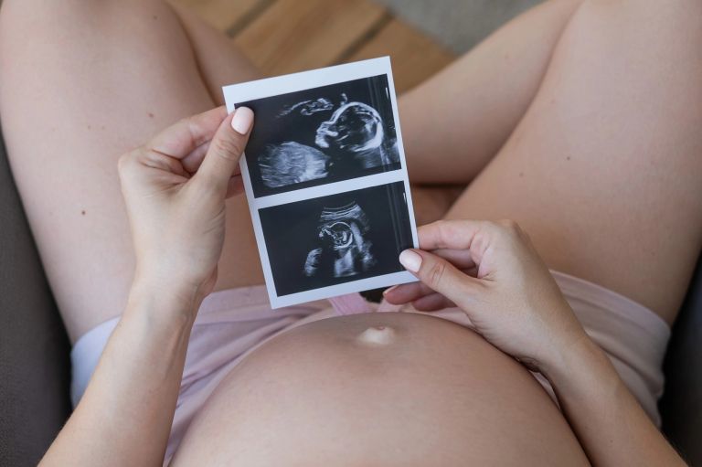 nosečnost, ultrazvok, slika