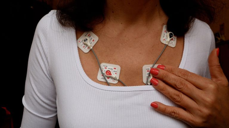 bolezni srca in ožilja.jpg