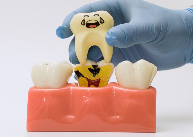 zob, zobna pulpa, pulpitis