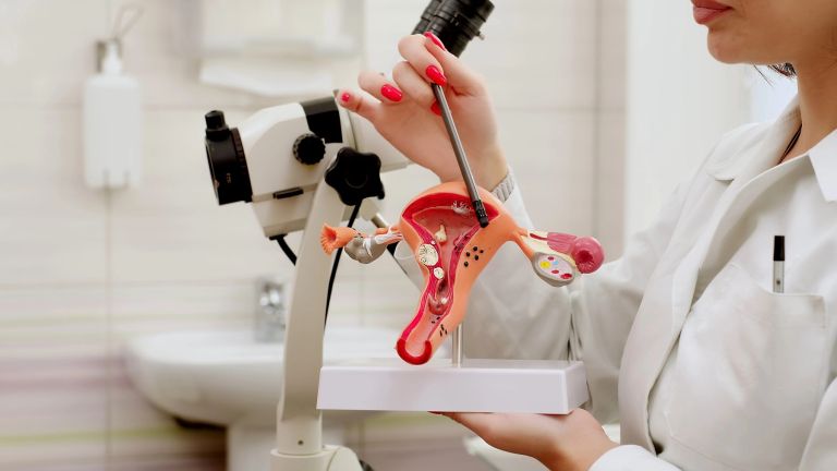 rodila, maternica, histerektomija