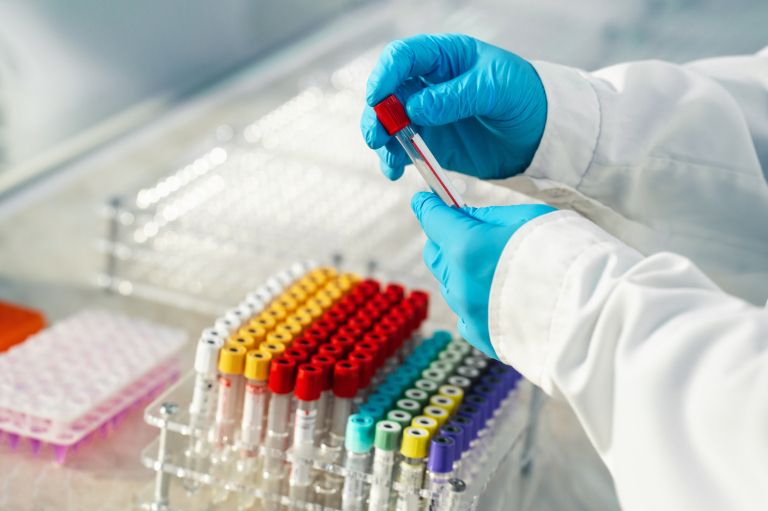 krvna slika izvid.jpg