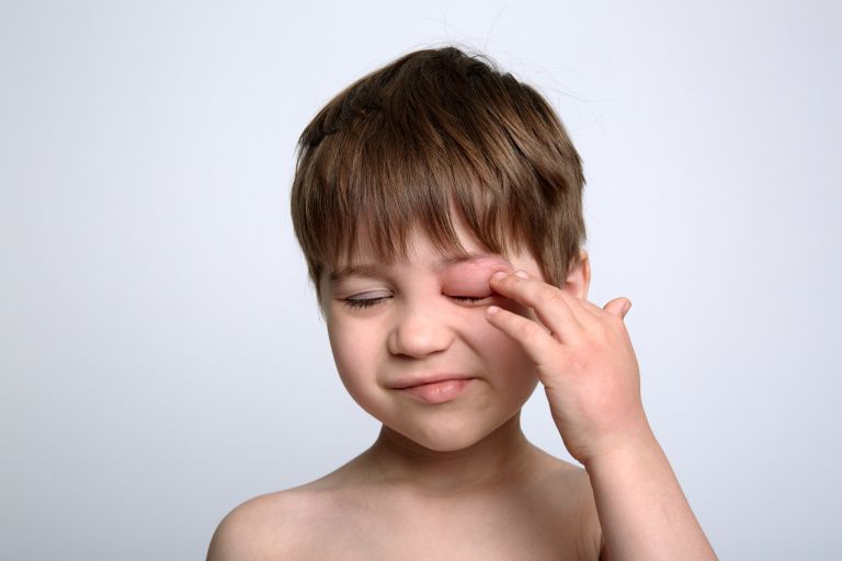 vneto oko pri otrocih.jpg