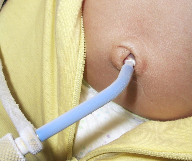 lapizacija, granulom