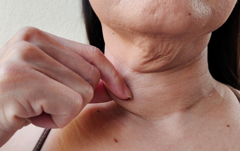 Neck lift, pomladitev, vrat