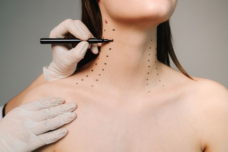 Neck lift, pomladitev, vrat