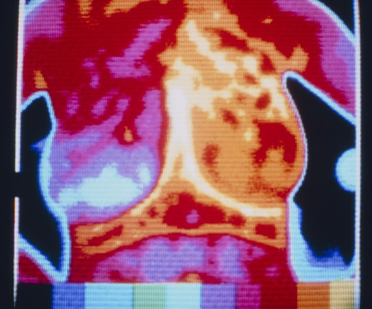 medicinska-termografija