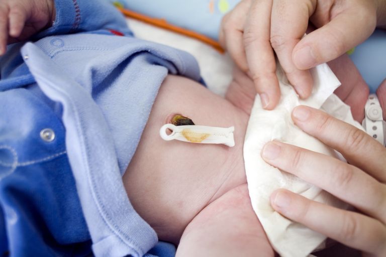 popek, novorojenček