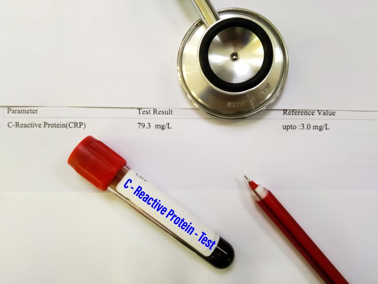 povišan CRP v krvi.jpg