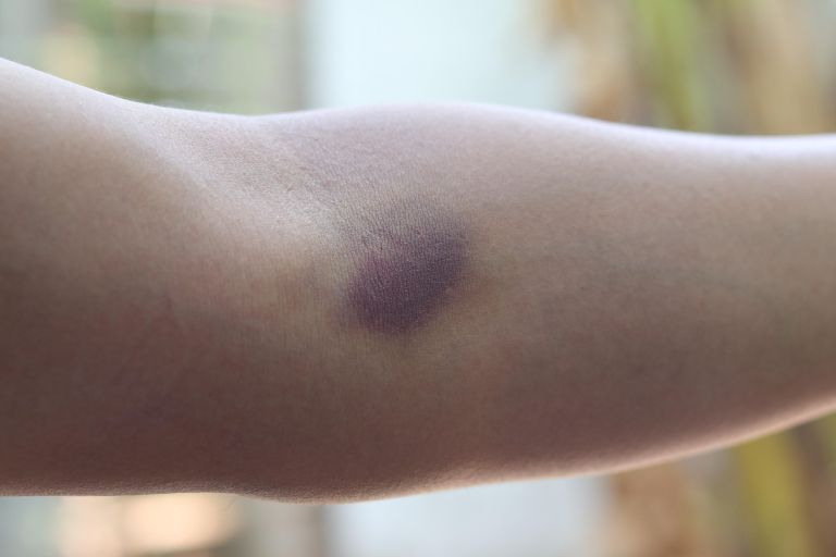 modrica, odvzem krvi