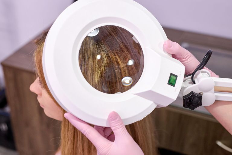 bradavice na glavi, dermatolog, lasišče