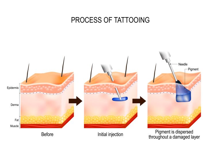 proces tetoviranja.jpg