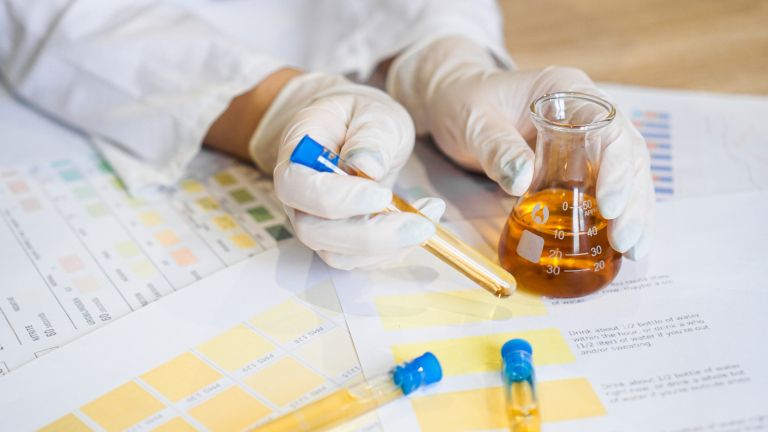 Urine color.jpg