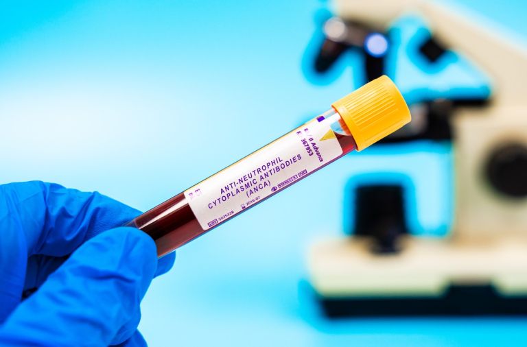 anca test.jpg