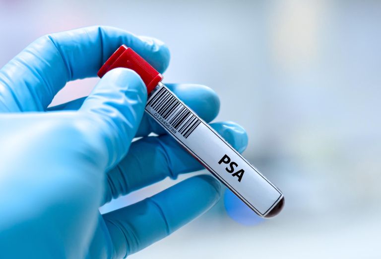 test-rak-prostate