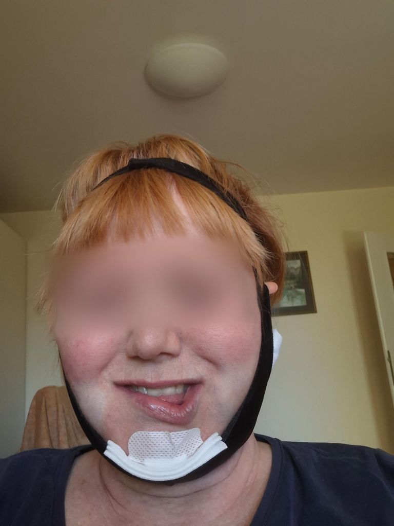 liposukcija1a.jpg