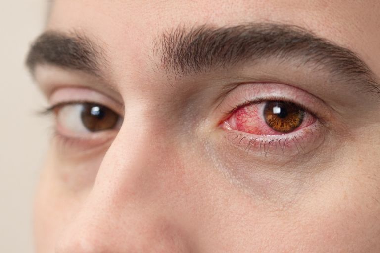 adenovirus.jpg