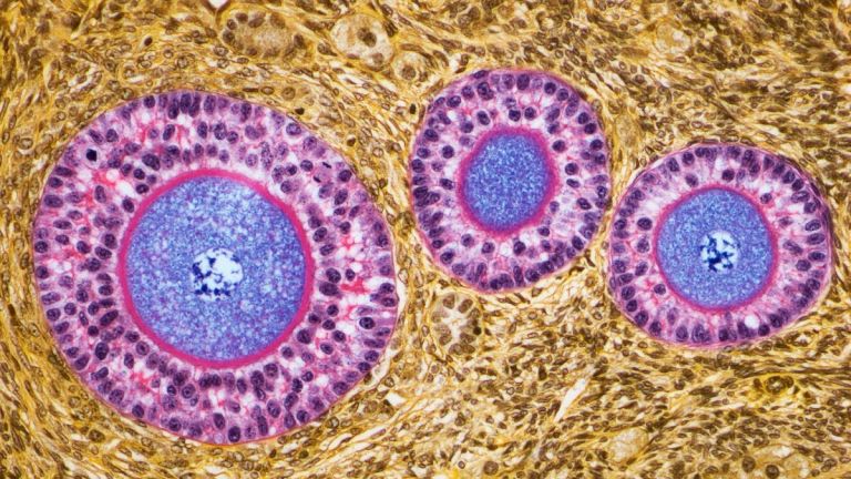 OvarianFollicles.jpg