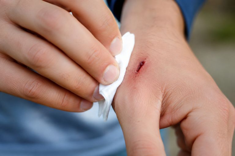 rana, tetanus, čiščenje rane.png