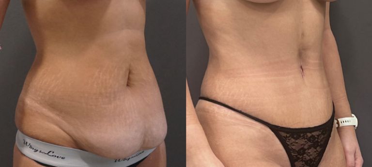 testen fotke before after.PNG