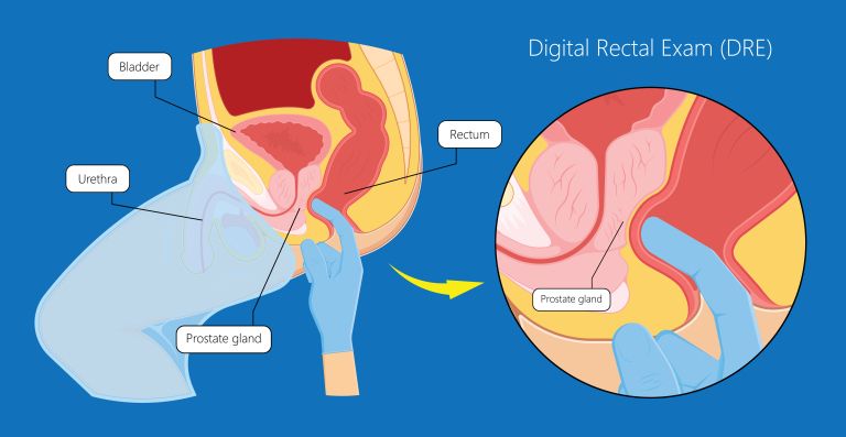 Digitorektalni pregled
