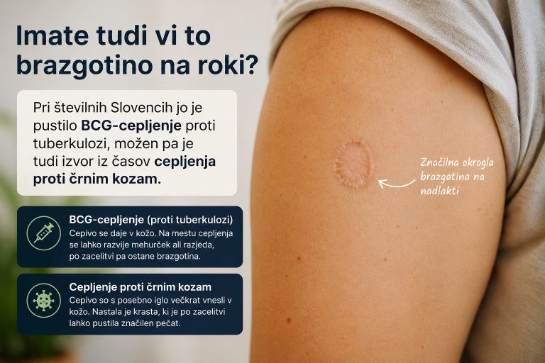 Brazgotina na roki, cepljenje