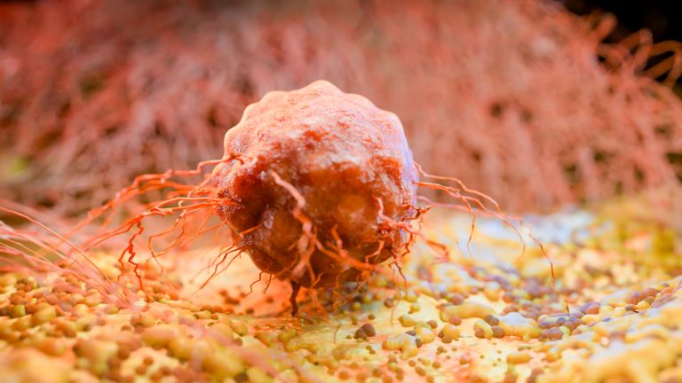 Tumor, markerji, rak, rakave celice, kri