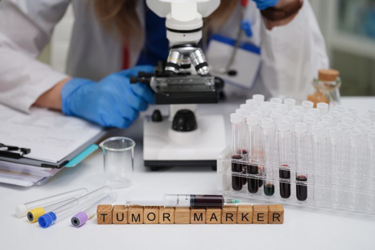 Tumor, markerji, rak, rakave celice, kri