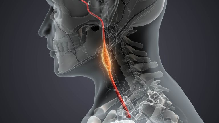 tumor4.jpg