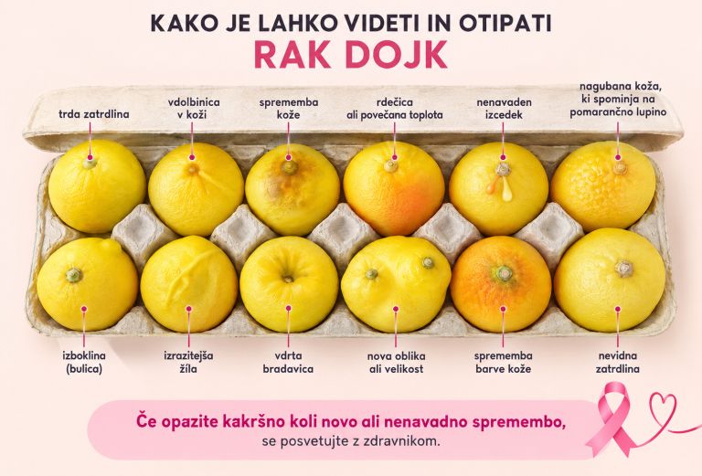 Limone, rak dojk