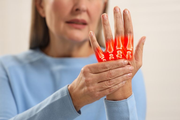 arthritis joint inflammation.jpg