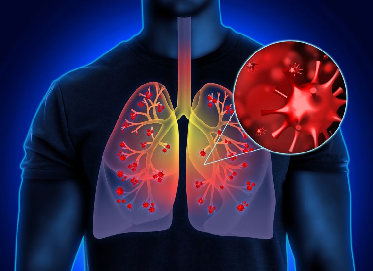 infected lungs.jpg