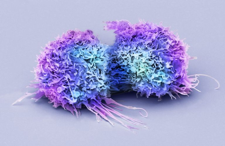 cancer under 50.jpg