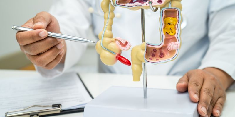 slepič, slepo črevo