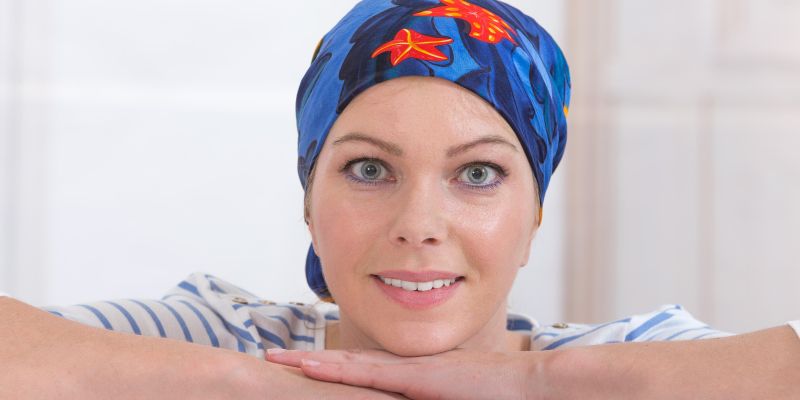 kemoterapija, izguba las