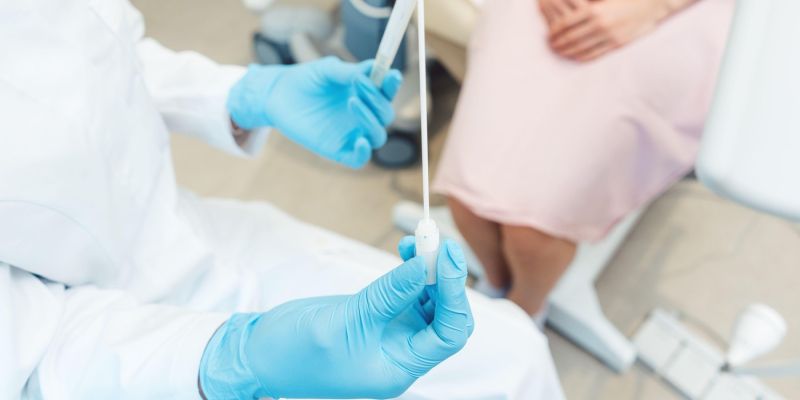 ginekolog, zdravnik, bris, spolno prenosljive bolezni